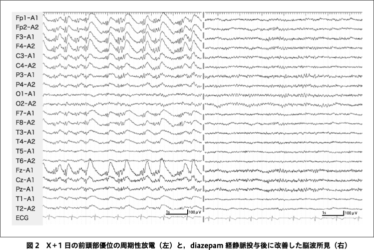 神経文字学 Neurogrammatology サイン入り 神経文字学: 読み書きの神経