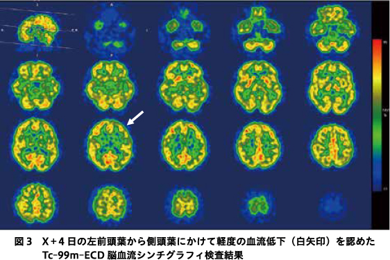精神神経学雑誌オンラインジャーナル
