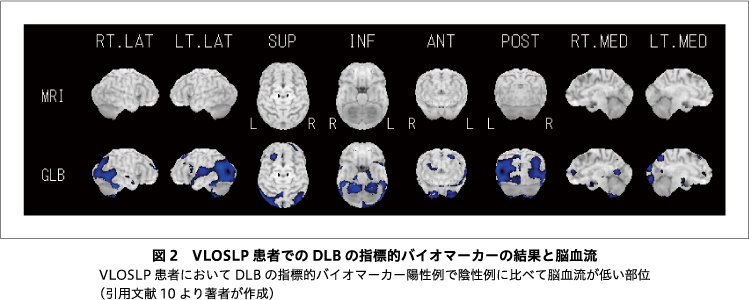 精神神経学雑誌オンラインジャーナル