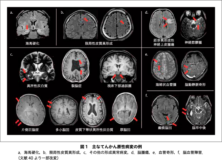 精神神経学雑誌オンラインジャーナル