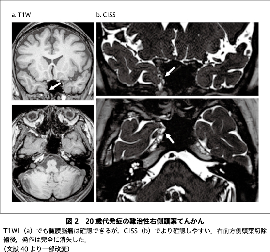 精神神経学雑誌オンラインジャーナル
