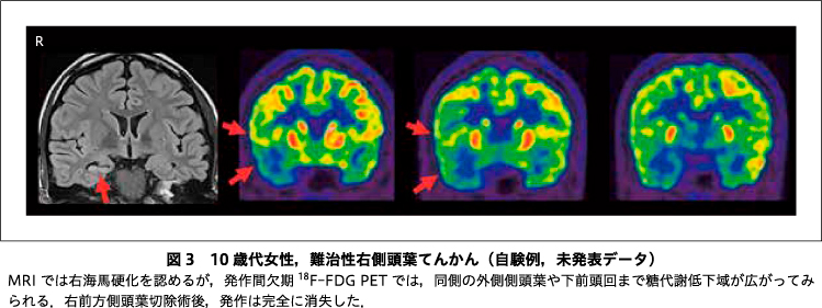 精神神経学雑誌オンラインジャーナル