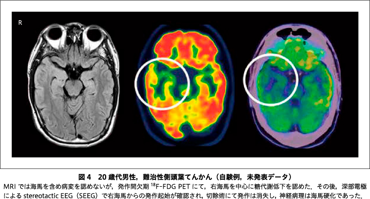 精神神経学雑誌オンラインジャーナル