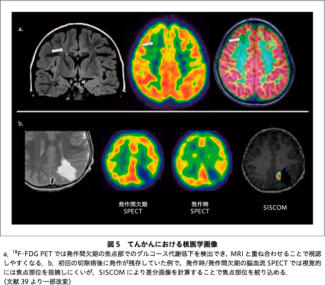 精神神経学雑誌オンラインジャーナル