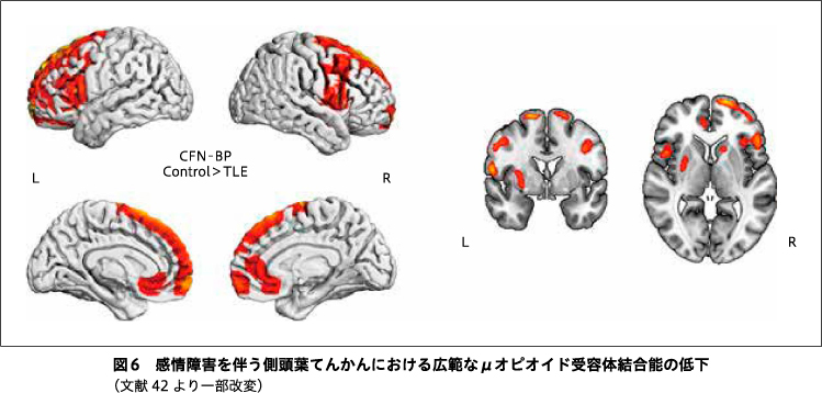 精神神経学雑誌オンラインジャーナル