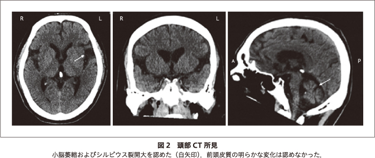 画像拡大