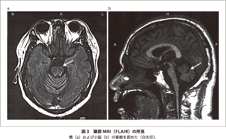 画像拡大
