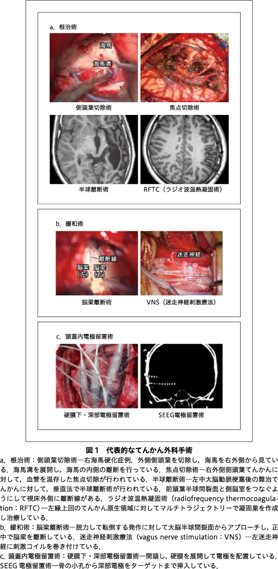 画像拡大